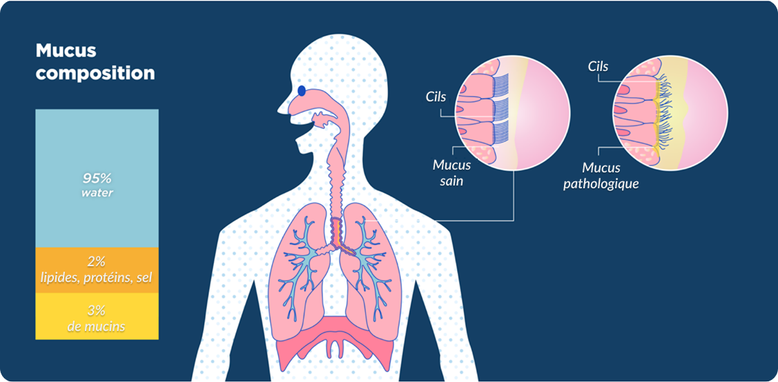 Group 1171275376 Bronchial Mucus image
